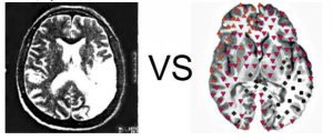 Patient L., 43 years old: Acute ischemic stroke