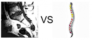 Patient A., aged 58: hepatoblastoma neck localization