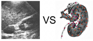 Patient K., 38 years old: Chronic inflammation of the bladder (chronic cystitis)